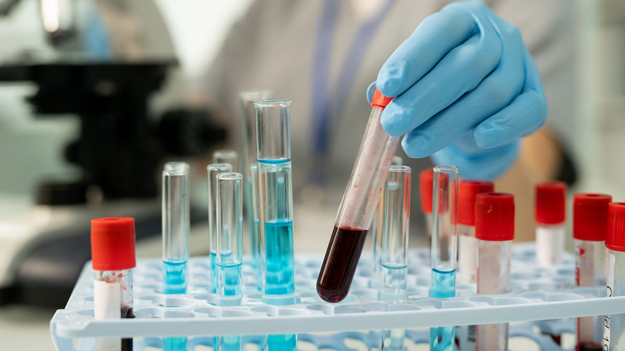 24/7 laboratory services at Sri Harinya Hospitals